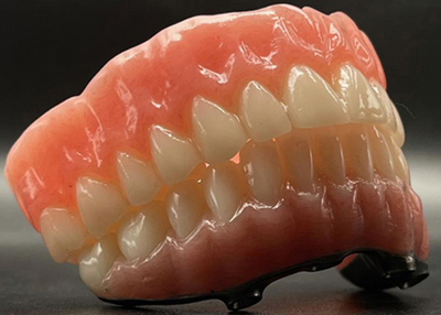 假牙（义齿）修复有几种