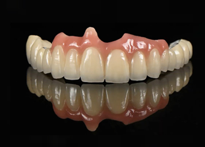 种植牙和传统的镶牙有什么区别